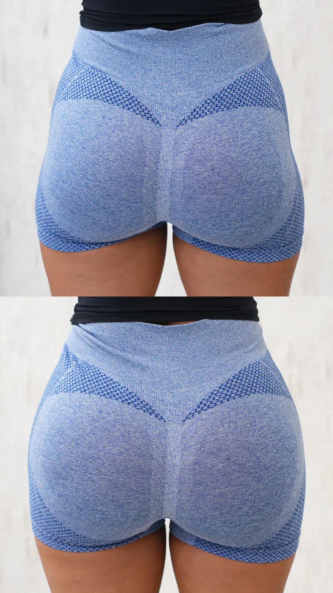Before and after results of butt filler treatment in Dubai, showing increased volume and contoured shape in blue athletic shorts.
