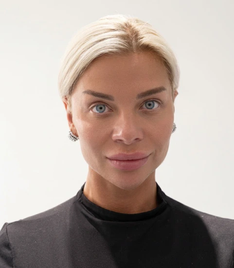 Face Lift in Dubai