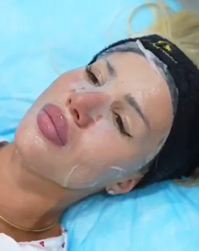 Hydrating sheet mask during HydraFacial at Tinkermoon Clinic Dubai