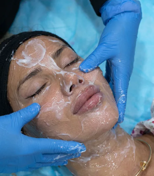 HydraFacial serum and mask application at Tinkermoon Clinic Dubai
