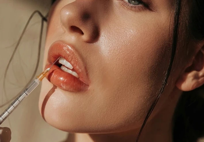 Lip Fillers Patient Guidelines and Aftercare in Dubai