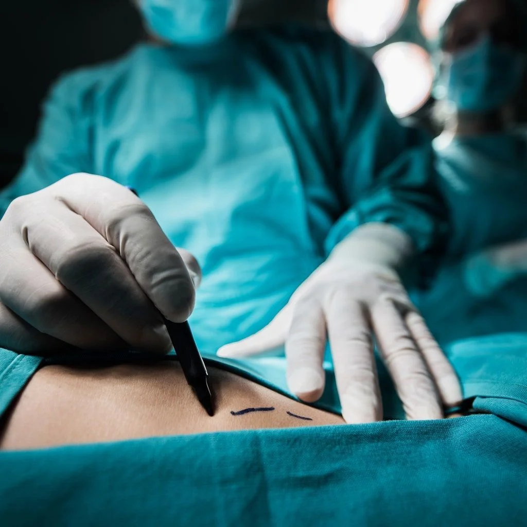 Types of Liposuction
