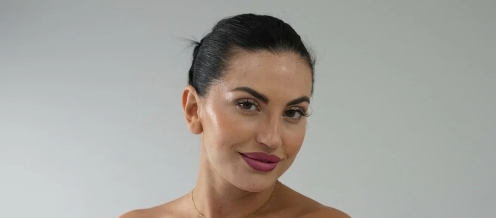 Botox does not work instantly