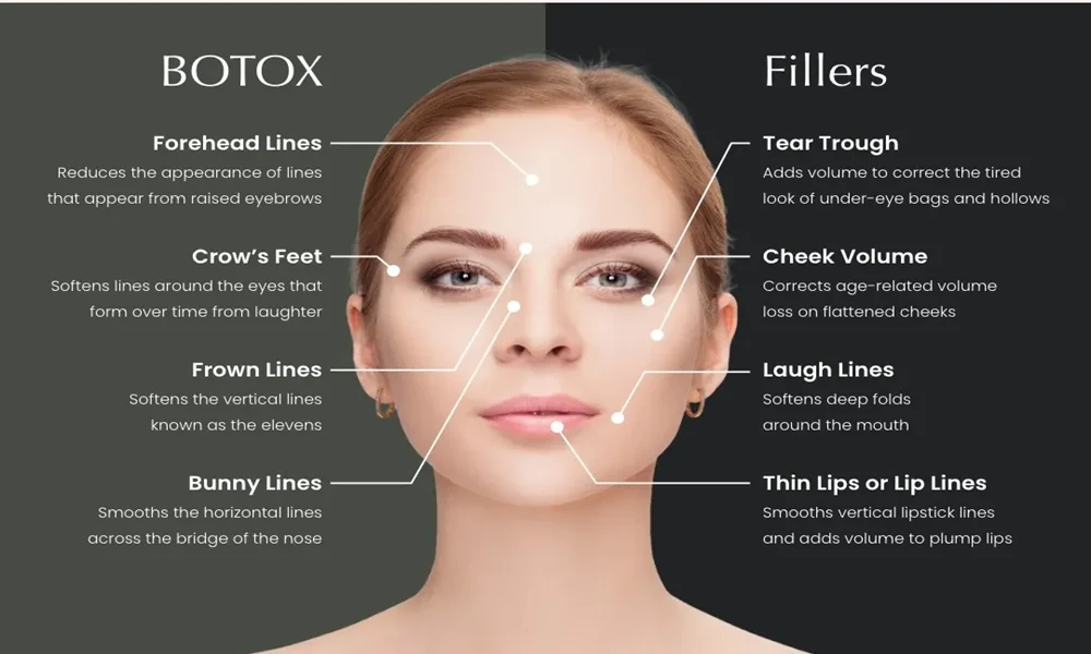 main difference between Botox and fillers