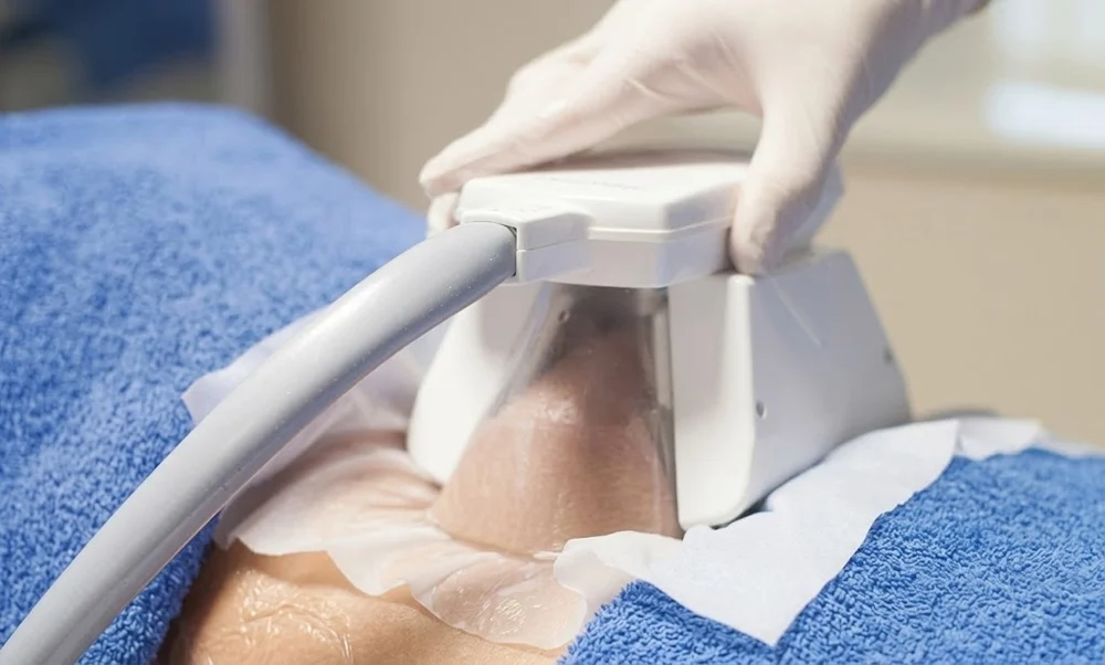 Cryolipolysis fat freezing treatment for localized fat reduction