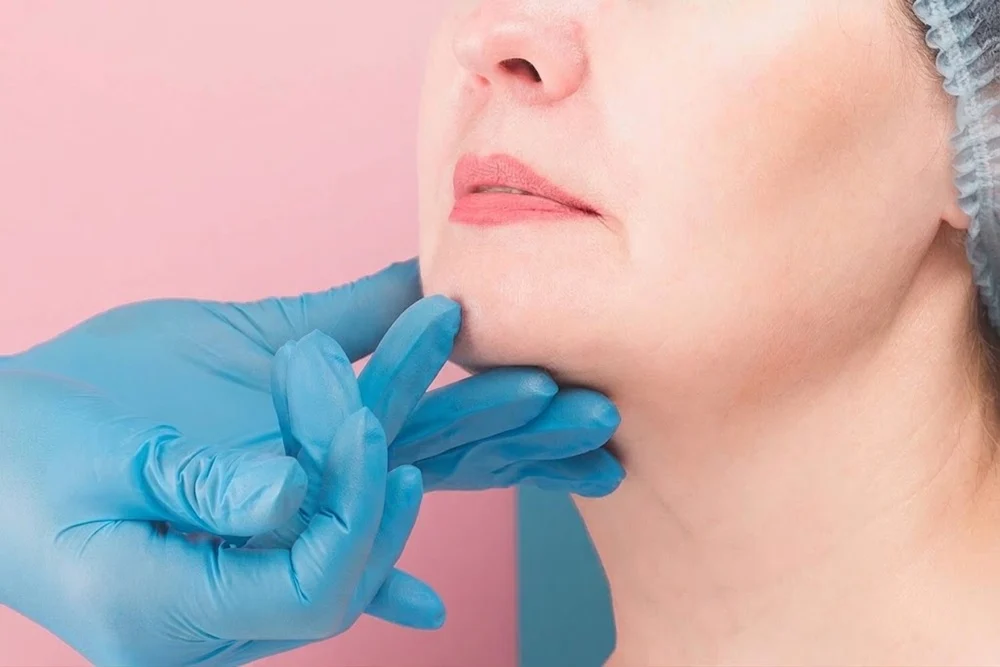 Combine Cheek Fillers and Jawline Fillers