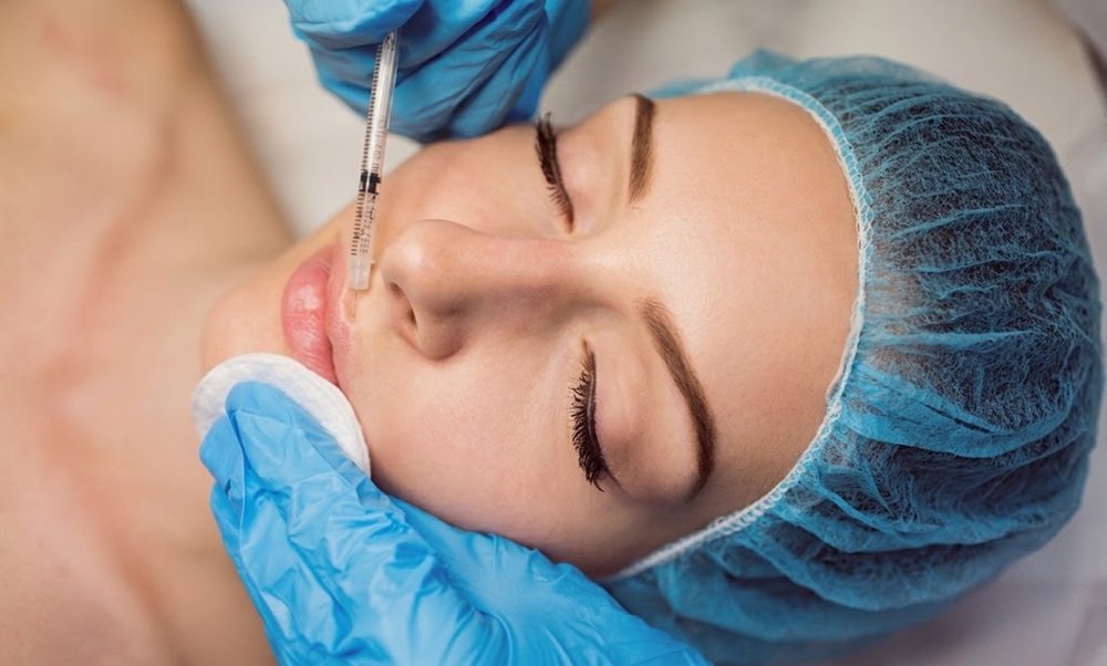 Dermal fillers, most commonly based on hyaluronic acid