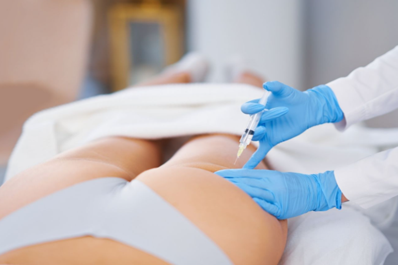 How Long Does Butt Filler Last