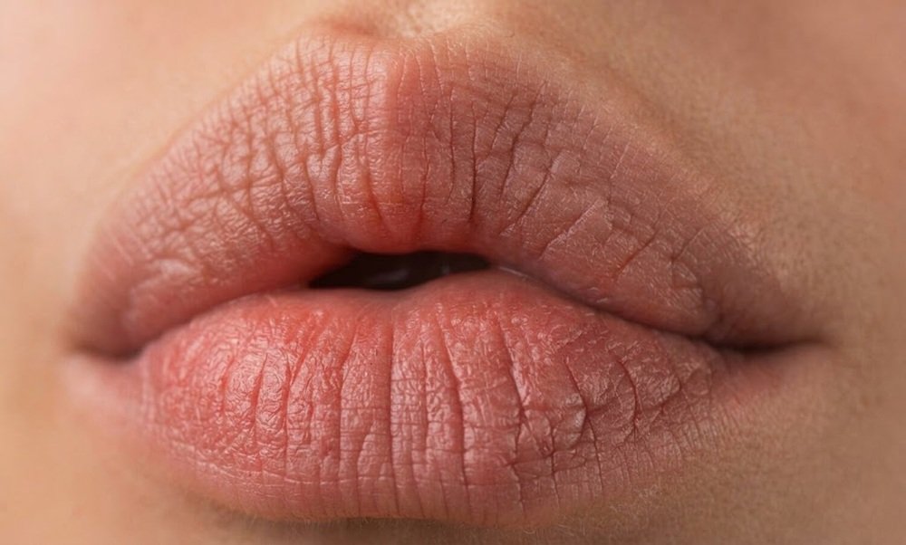 Heart-Shaped Lips