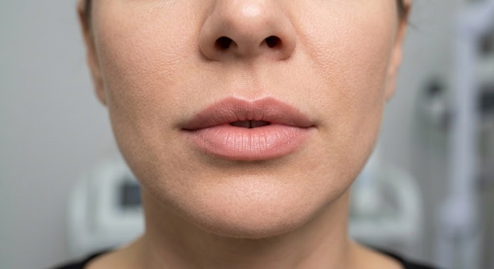Keyhole Lips