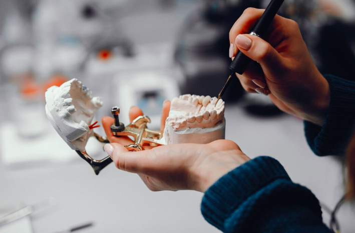 What are Dental Implants?