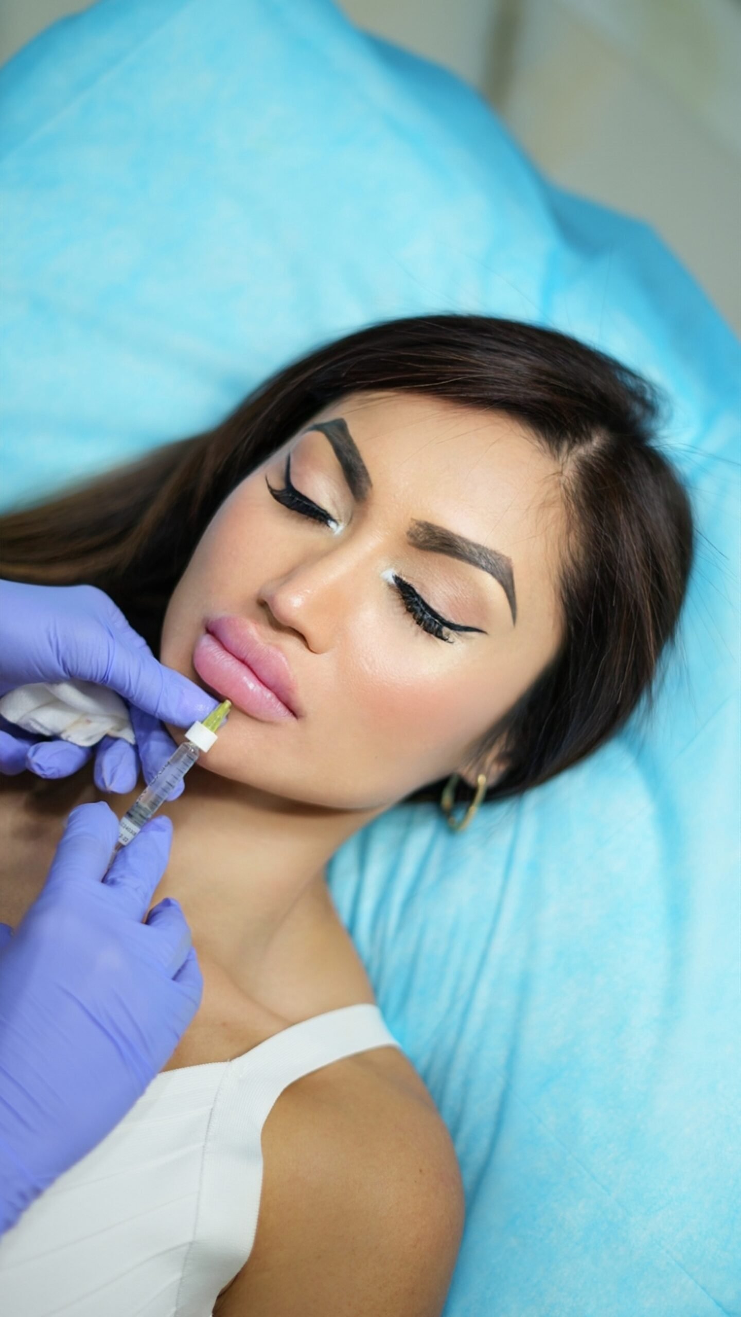 Who is a Good Candidate for Dermal Fillers?