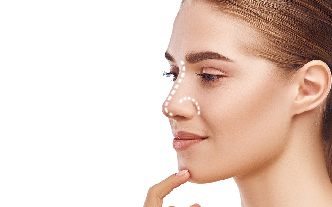 Does Rhinoplasty Leave Scars?
