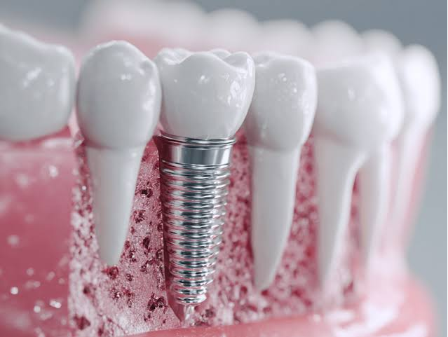 How the Procedure Works?