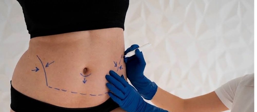 body contouring 
