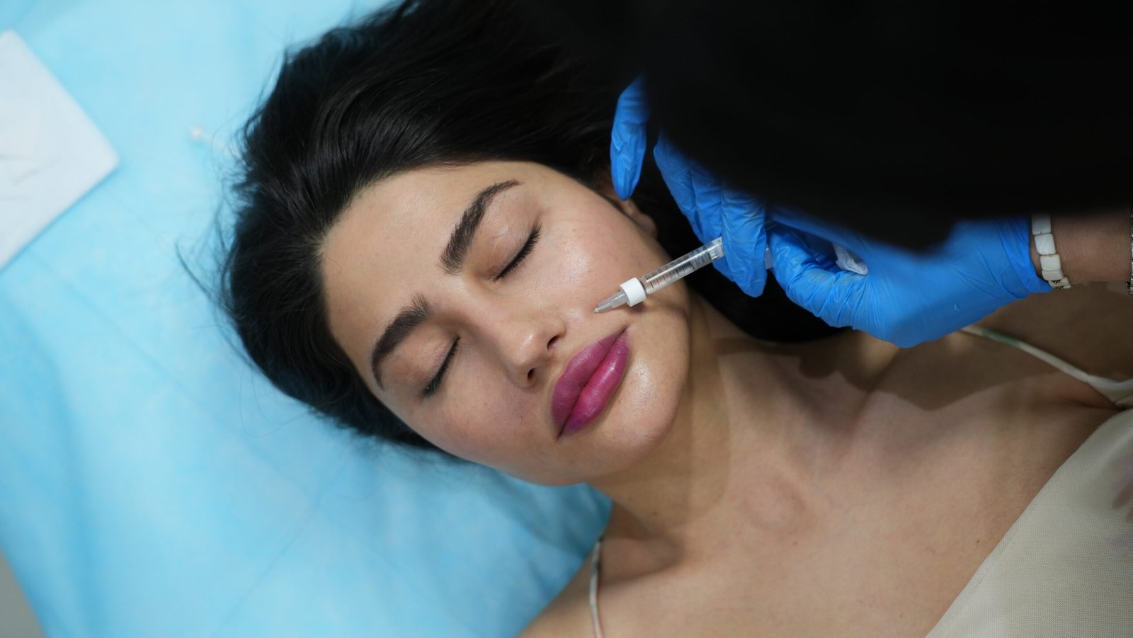 What are Dermal Fillers?