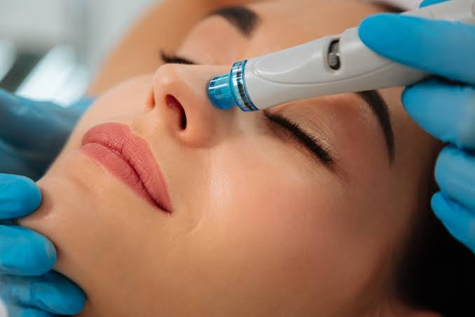 كم مرة يجب إجراء HydraFacial؟