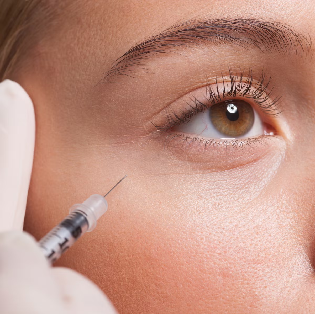 Is Botox Right for You?