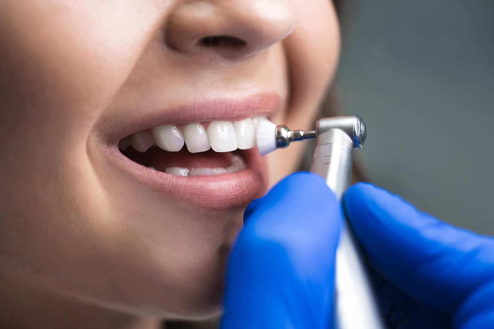 How Often Should You Get Dental Cleaning?