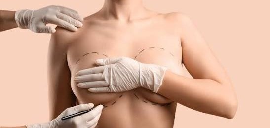 Breast Fillers