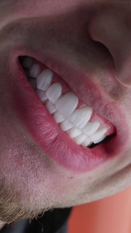 Dental