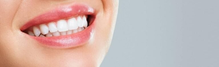 Hollywood Smile