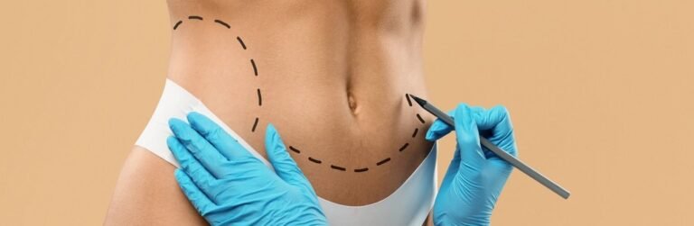 Liposuction