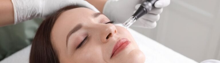 Microneedling RF