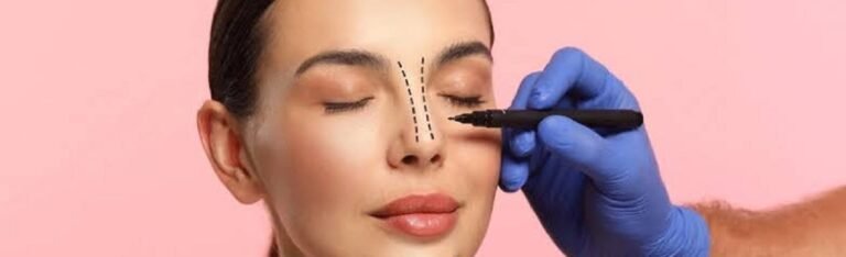 Rhinoplasty