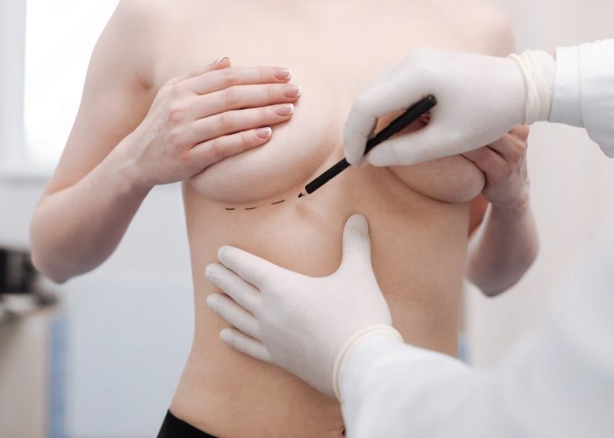 Aesthetic breast fillers outcome visualization at Tinkermoon