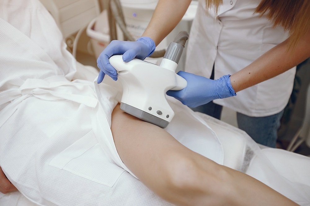 Laser-Assisted Liposuction