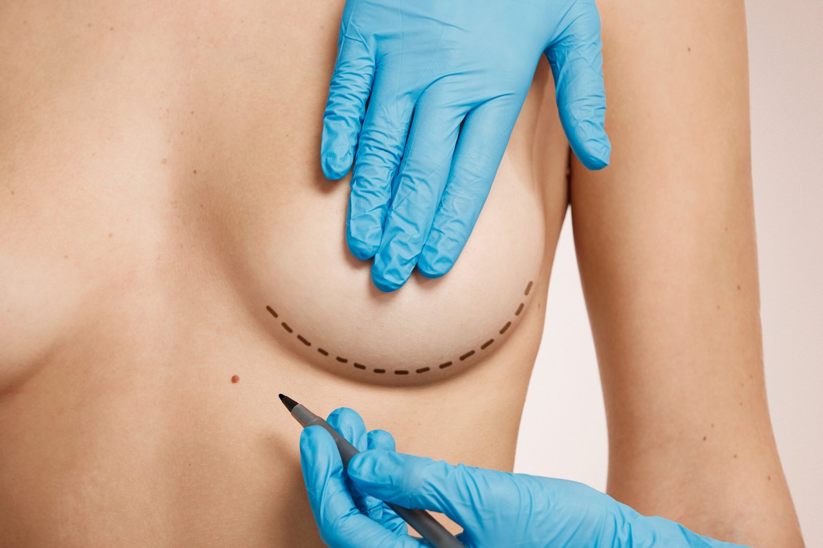 Cosmetic treatment planning and markings at Tinkermoon Clinic