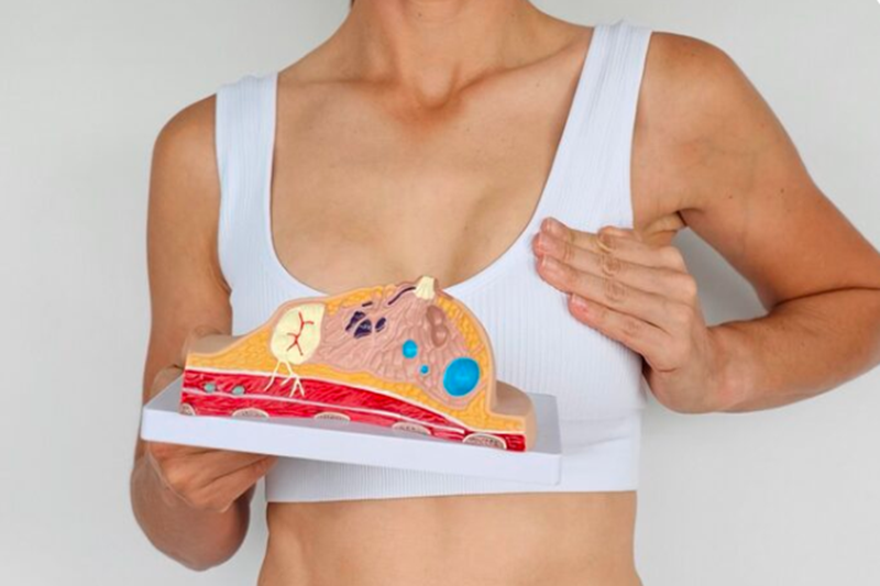 Breast Density Levels: What Do They Mean?