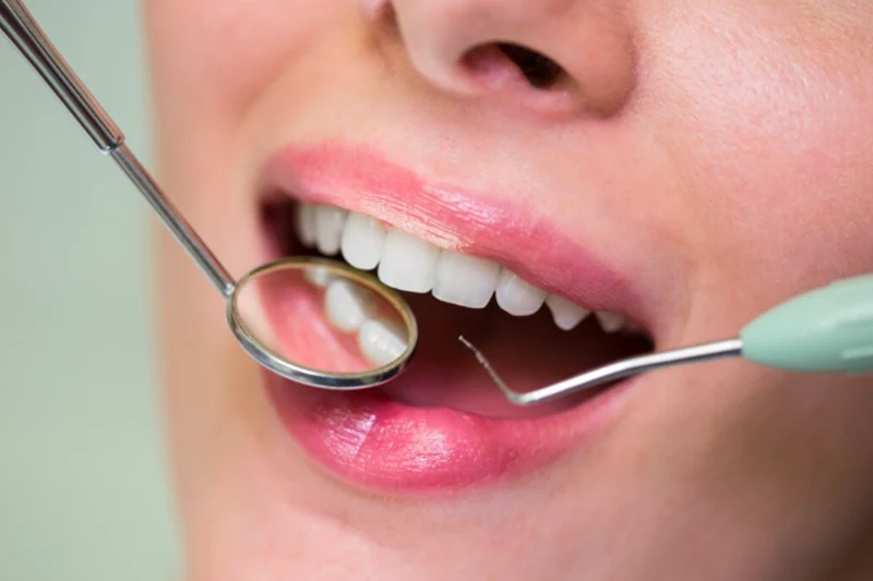 Remove Plaque from Teeth