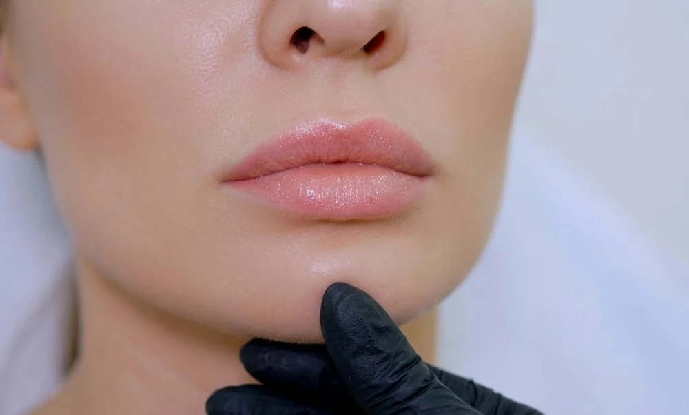 Most modern lip fillers are made with hyaluronic acid