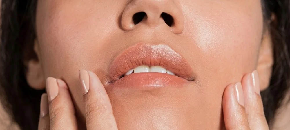 Several established hyaluronic acid fillers are used for lip augmentation