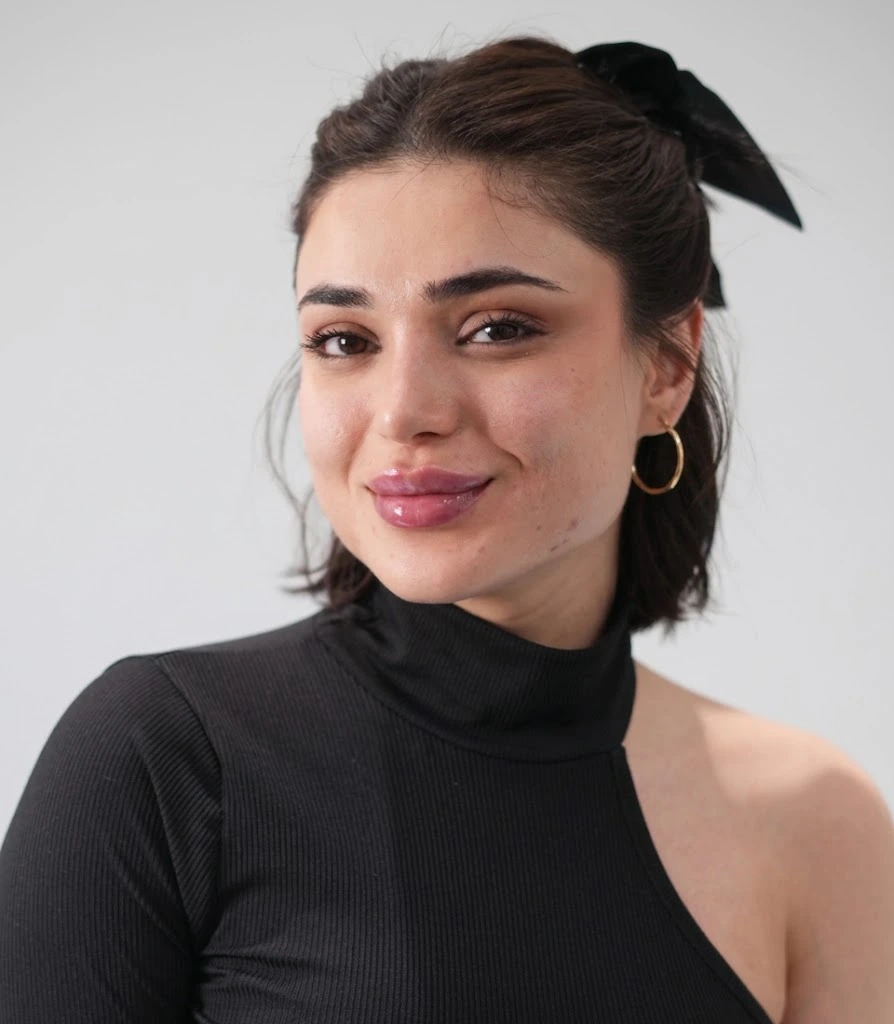Close-up portrait of a woman showing natural-looking, voluminous lips after a lip filler treatment at Tinkermoon Clinic Dubai
