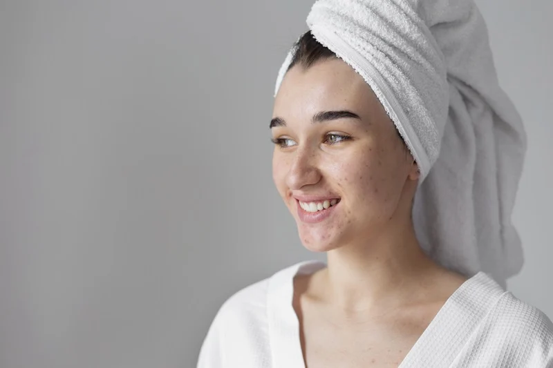 Pimples After HydraFacial
