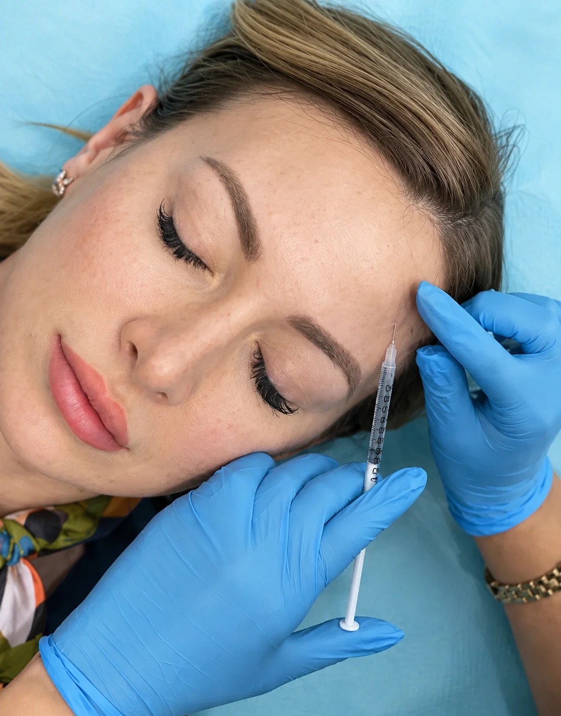Can Botox Be Combined with Other Aesthetic Treatments?